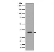 CD8A Antibody for WB - Jurkat cell lysate. Western blot analysis of CD8 alpha (CD8A) in human Jurkat cell lysate shows a band at approximately 26-35 kDa, consistent with the predicted molecular weight and glycosylation-dependent migration of this membrane glycoprotein. The signal reflects endogenous CD8A expression in this T cell leukemia model, supporting use in western blot analysis of Jurkat cells for studies of T cell signaling and immune-related pathways (clone EAF-3).