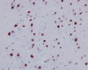 Acetyl-Histone H2A Antibody Lys9 / HIST1H2A Chromatin Accessibility Antibody (clone DEB-8) for IHC. Immunohistochemistry of HIST1H2A / Histone H2A Lys9 acetylation (H2AK9ac) in mouse brain tissue. Formalin-fixed, paraffin-embedded mouse brain sections show strong HRP-DAB brown nuclear staining in neuronal and glial cells, consistent with nuclear localization of acetylated Histone H2A and chromatin accessibility. Heat-induced epitope retrieval was performed using pH6 citrate buffer.