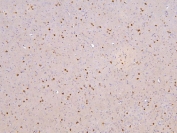 IHC staining of FFPE rat brain with RBMS3 antibody. HIER: boil tissue sections in pH6, 10mM citrate buffer, for 20 min and allow to cool before testing.