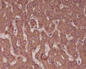 ALPL Antibody Liver IHC. Immunohistochemistry staining of FFPE human liver tissue with ALPL antibody. HIER: boil tissue sections in pH6, 10mM citrate buffer, for 10-20 min and allow to cool before testing.