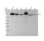 CD54 Antibody DOD-9 in Human Cancer Cell Lines WB. Western blot testing of human HepG2, SiHa, K562, A431, Ramos, and HeLa cell lysates with CD54 Antibody clone DOD-9 shows predominant bands at approximately 90-110 kDa, with variable intensity among samples. Lanes 1-6: HepG2, SiHa, K562, A431, Ramos, and HeLa, respectively. Although unmodified ICAM1/CD54 has a predicted molecular weight of approximately 58 kDa, extensive N-linked glycosylation accounts for the higher apparent molecular weight. This Major Rhinovirus Receptor Antibody detects bands within the expected range for mature glycosylated ICAM1.