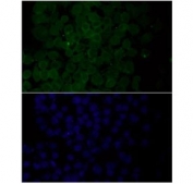 Fyn Antibody HeLa Cell IF. Immunofluorescent staining of FFPE human HeLa cells with Fyn antibody (green) and DAPI nuclear stain (blue).