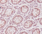 IHC staining of FFPE human colon tissue with CDK1 antibody. HIER: boil tissue sections in pH6, 10mM citrate buffer, for 10-20 min and allow to cool before testing.