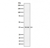 CD23 Antibody Raji Cell WB. Western blot testing of human Raji cell lysate with CD23 antibody. Expected molecular weight: 37-45 kDa.