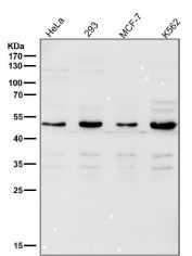 LPL Antibody Multi-Cell Line Western Blot. Western blot analysis of human HeLa, HEK293, MCF-7, and K562 cell lysates using LPL Antibody demonstrates a prominent band at approximately 48-50 kDa across all tested cell lines, consistent with the expected molecular weight range of Lipoprotein Lipase (LPL). LPL is a key enzyme involved in triglyceride hydrolysis, fatty acid mobilization, and lipid utilization, facilitating the release of free fatty acids from circulating lipoproteins for cellular uptake and energy metabolism. Detection of LPL in multiple human cell lines supports its role in lipid processing and metabolic regulation across diverse cellular contexts. All lanes were probed using antibody diluted 1:2000 for 1 hour at room temperature.