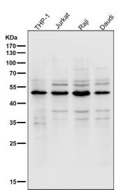 LPL Antibody Hematopoietic Cell Line Western Blot. Western blot analysis of human THP-1, Jurkat, Raji, and Daudi cell lysates using LPL Antibody demonstrates a prominent band at approximately 48-50 kDa across all tested cell lines, consistent with expression of Lipoprotein Lipase (LPL). LPL is a key enzyme involved in triglyceride hydrolysis, fatty acid mobilization, and lipid utilization, facilitating the release of free fatty acids from circulating lipoproteins for cellular uptake and metabolic processes. Detection of LPL in monocyte-, T-cell-, and B-cell-derived cell lines supports its role in cellular lipid handling and energy metabolism across diverse hematopoietic cell populations. All lanes were probed using antibody diluted 1:2000 for 1 hour at room temperature.
