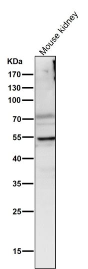 LPL Antibody Mouse Kidney Western Blot. Western blot analysis of mouse kidney tissue lysate using LPL Antibody demonstrates a prominent band at approximately 55 kDa, consistent with expression of Lipoprotein Lipase (LPL). LPL is a key enzyme involved in triglyceride hydrolysis, fatty acid mobilization, and lipid utilization, facilitating the release of free fatty acids from circulating lipoproteins for cellular uptake and metabolic activity. Detection of LPL in kidney tissue is consistent with the importance of lipid metabolism and energy homeostasis in renal physiology. Lane probed using antibody diluted 1:2000 for 1 hour at room temperature.