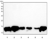 FABP1 Antibody Liver Tissue and Cell Line WB. Western blot testing of 1) human HCCT, 2) human HCCP, 3) human HepG2, 4) rat liver, 5) rat RH35 and 6) mouse liver tissue lysate with FABP1 antibody. Predicted molecular weight ~14 kDa.