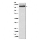 NF-M Antibody Human 293T Cell WB. Western blot testing of human 293T cell lysate using NF-M Antibody, clone AAGI-14. A prominent band is detected at approximately 145-160 kDa, consistent with the characteristic migration of heavily phosphorylated neurofilament medium chain, despite a predicted molecular weight of approximately 102 kDa. The slower electrophoretic mobility reflects extensive post-translational phosphorylation, a well-established feature of NF-M. These results demonstrate that NF-M Antibody, a Neurofilament Medium Chain Antibody, specifically detects endogenous NF-M in human cells.