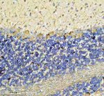 NF-M Antibody Rat Cerebellum IHC. Immunohistochemical analysis of FFPE rat cerebellum tissue using NF-M Antibody. Heat-induced epitope retrieval was performed in pH 8.0 EDTA buffer prior to incubation with the primary antibody overnight at 4Â°C. An HRP-conjugated goat anti-rabbit secondary antibody with DAB chromogen was used for visualization. Distinct cytoplasmic and neurite staining is observed in cerebellar neurons, with prominent immunoreactivity within the Purkinje cell layer and neuronal processes, consistent with the expected distribution of neurofilament medium chain. These results demonstrate that NF-M Antibody, a Neurofilament Medium Chain Antibody, specifically detects endogenous NEFM in FFPE rat nervous tissue.