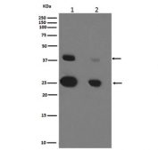 CTSD Antibody MCF7 and SK-BR-3 WB. Western blot testing of human 1) MCF7 and 2) SK-BR-3 cell lysate with CTSD antibody. Expected molecular weight: 43-46 kDa and 28 kDa (heavy chain).