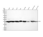 ANXA2 Antibody ABDG-1 in Human, Mouse and Rat WB. Western blot testing of clone ABDG-1 in human A549 lung carcinoma, U251 glioma, A431 epidermoid carcinoma and RT4 bladder cancer cell lysates, rat lung and liver tissue lysates, and mouse lung and liver tissue lysates. Samples were tested under reducing conditions with 30 ug loaded per lane. A strong band is observed at approximately 36 kDa across all tested samples, consistent with the calculated molecular weight of Annexin A2 at 38.6 kDa. This ANXA2 Antibody demonstrates recognition of endogenous Annexin II in human, mouse and rat samples.