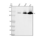 Recombinant Involucrin Antibody ABEA-9 Western Blot of A431, HaCaT and RT4 Cells. Western blot testing of human A431 (lane 1), HaCaT (lane 2), and RT4 (lane 3) whole cell lysates under reducing conditions with Recombinant Involucrin Antibody clone ABEA-9. A predominant IVL band is detected at approximately 120 kDa in all three lysates, with stronger signal in HaCaT and RT4 cells than A431 cells. Although the calculated molecular weight of involucrin is approximately 68 kDa, its glutamine-rich repetitive sequence causes characteristically anomalous migration on SDS-PAGE. The observed banding pattern supports specific detection of involucrin using this IVL Rabbit Monoclonal Antibody.