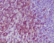 CD3e Antibody. Immunohistochemistry analysis of CD3 Epsilon / CD3E antibody in FFPE mouse spleen tissue using CD3e Antibody / Immune Cell Profiling Marker Antibody. Strong HRP-DAB brown membranous and cytoplasmic staining is observed in T lymphocytes distributed throughout splenic white pulp regions, consistent with T-cell localization within lymphoid follicles and periarteriolar lymphoid sheaths, while surrounding non-lymphoid areas show minimal background. The staining supports identification of CD3-positive T-cell populations within the broader immune cell landscape. Heat-induced epitope retrieval was performed by boiling tissue sections in pH 6, 10 mM citrate buffer for 10-20 minutes followed by cooling prior to antibody incubation.