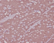 Synaptophysin Antibody Recombinant Rabbit MAb Clone BGB-19. Immunohistochemistry analysis of FFPE mouse brain tissue demonstrates widespread cytoplasmic HRP-DAB brown staining within neurons and surrounding neuropil, consistent with Synaptophysin (SYP) localization in presynaptic vesicle membranes. The staining pattern highlights synapse-rich neuronal regions where synaptic vesicles are densely distributed along neuronal processes. Hematoxylin counterstain marks nuclei in blue. The recombinant rabbit monoclonal Synaptophysin antibody clone BGB-19 was used to detect synaptic vesicle protein expression in mouse brain tissue. Heat-induced epitope retrieval was performed by boiling tissue sections in pH6 10mM citrate buffer for 10-20 minutes followed by cooling prior to staining.