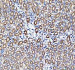 WNT4 Antibody Mouse Kidney IHC. Immunohistochemical analysis of FFPE mouse kidney tissue using WNT4 Antibody. Heat-induced epitope retrieval was performed in pH 8.0 EDTA buffer prior to incubation with the primary antibody at 2 ug/mL overnight at 4Â°C. An HRP-conjugated goat anti-rabbit secondary antibody with DAB chromogen was used for visualization. Prominent cytoplasmic staining is observed throughout the renal tubular epithelium, while glomeruli show comparatively weaker immunoreactivity, consistent with endogenous WNT4 expression in mouse kidney. These results demonstrate that WNT4 Antibody, a Developmental Signaling Protein Antibody, specifically detects endogenous WNT4 in FFPE mouse tissue.
