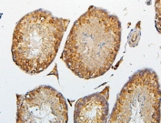 IHC staining of FFPE mouse testis with CRB1 antibody. HIER: boil tissue sections in pH6, 10mM citrate buffer, for 20 min and allow to cool before testing.