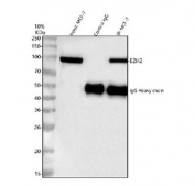 EZH2 Antibody IP. Immunoprecipitation of EZH2 protein from 500ug of human MCF7 whole cell lysate with 2ug of EZH2 antibody.