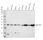 FRZB Antibody Human, Mouse and Rat WB. Western blot analysis detected FRZB in human U251 (lane 1), SH-SY5Y (lane 2), HepG2 (lane 3) and PC-3 (lane 4) cell lysates, as well as rat kidney (lane 5), rat brain (lane 6), mouse kidney (lane 7) and mouse brain (lane 8). A specific immunoreactive band was observed at approximately 36 kDa, consistent with the predicted molecular weight of FRZB. Stronger expression was evident in rat and mouse brain tissues, reflecting the importance of this secreted Wnt signaling regulator in neural development and tissue homeostasis. This FRZB Antibody, a Secreted Wnt Antagonist Antibody, demonstrates cross-species reactivity for studies of Wnt signaling, skeletal development and extracellular pathway regulation.