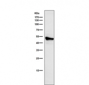 Western blot testing of human HeLa cell lysate with Cytokeratin 7 antibody. Predicted molecular weight ~51 kDa.