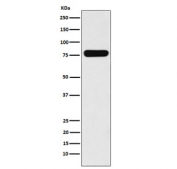 VIL1 Antibody for WB. Western blot analysis of Villin-1 (VIL1) using human Caco-2 cell lysate with VIL1 Antibody / Calcium-Regulated Actin Protein Antibody (clone VIL1/5521R). Lane 1: human Caco-2 lysate. A band is detected at approximately 93 kDa, consistent with the predicted molecular weight of Villin-1 (VIL1). This signal supports the presence of Villin in intestinal epithelial cells and aligns with its role as a calcium-regulated actin-binding protein involved in cytoskeletal signaling and filament dynamics.