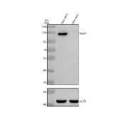 PARP1 Antibody Knockout Validation WB. Western blot analysis of human HeLa-WT and HeLa KO whole cell lysates using PARP1 antibody clone CFD-16. A strong band is detected near 118 kDa in wild-type HeLa lysate, consistent with the predicted molecular weight of full-length PARP1, while knockout lysate demonstrates complete loss of signal, supporting highly specific detection of this chromatin-associated DNA repair enzyme. ACTB is shown as a loading control. The observed knockout validation pattern supports the role of PARP1 in DNA strand break repair, genomic stability maintenance, and nuclear stress-response signaling pathways.