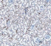 PARP1 Antibody Rat Kidney IHC. Immunohistochemistry analysis of FFPE rat kidney tissue using recombinant rabbit monoclonal PARP1 antibody clone CFD-16. Renal tubular epithelial cells demonstrate prominent nuclear HRP-DAB brown staining consistent with the chromatin-associated localization of PARP1 in DNA strand break repair and genomic stability maintenance pathways, while surrounding stromal regions show comparatively lower signal intensity. Nuclei are counterstained blue. Heat-mediated antigen retrieval was performed in pH8 EDTA buffer prior to staining.