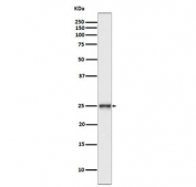 Western blot testing of human SH-SY5Y cell lysate with PGP9.5 antibody. Predicted molecular weight ~25 kDa.