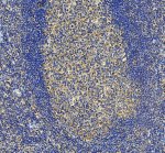 IL-31 Antibody in Human Tonsil Lymphoid Follicles by IHC. Immunohistochemistry of FFPE human tonsil sections using IL-31 Antibody at 2 ug/ml. The image shows heterogeneous cytoplasmic immunoreactivity within the lymphoid tissue, with stronger brown staining in lighter interfollicular and follicular cell populations and comparatively weak staining within densely packed lymphocyte-rich regions. This second field provides a complementary view of IL-31 distribution within human tonsil. HIER was performed using EDTA buffer at pH 8.0, supporting tissue-based validation of the Interleukin 31 Polyclonal Antibody.