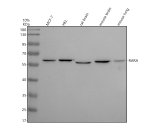 Retinoic Acid Receptor Alpha Antibody WB in Human and Rodent Samples. Western blot analysis of human MCF-7 (lane 1) and HEL (lane 2) whole cell lysates, rat brain (lane 3), mouse brain (lane 4), and mouse lung (lane 5) lysates using the RARA Monoclonal Antibody GBC-18 at 1:500. Samples containing 30 ug of total protein per lane were separated by 10% SDS-PAGE under reducing conditions. A prominent band is detected at approximately 55-60 kDa across all five samples, above the predicted molecular weight of RARA (~51 kDa).