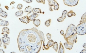 IHC staining of FFPE human placenta with MID1 antibody. HIER: boil tissue sections in pH6, 10mM citrate buffer, for 20 min and allow to cool before testing.