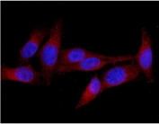 Immunofluorescent staining of FFPE human U-2 OS cells with MID1 antibody (red) and DAPI nuclear stain (blue). HIER: steam section in pH6 citrate buffer for 20 min.