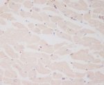 MLC2 Monoclonal Antibody FHO-13 by IHC in Human Heart Immunohistochemistry of FFPE human heart sections using MLC2 Monoclonal Antibody clone FHO-13. Cytoplasmic staining is observed throughout cardiomyocytes, consistent with localization of MYL2/MLC2 within the cardiac contractile apparatus. This Myosin Light Chain 2 Rabbit Monoclonal produces widespread myocardial labeling with limited nuclear staining.