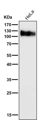 Western blot testing of human HeLa cell lysate with CD107A antibody. This heavily glycosylated protein of 417 amino acids is visualized at up to 140 kDa.