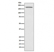 ACE Antibody Human Fetal Kidney WB. Western blot testing of human fetal kidney lysate with ACE antibody. Predicted molecular weight: 140-170 kDa.