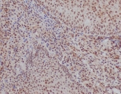 Ku70 Antibody Tonsil IHC. Immunohistochemistry staining of FFPE human tonsil tissue with Ku70 antibody. HIER: boil tissue sections in pH6, 10mM citrate buffer, for 10-20 min and allow to cool before testing.