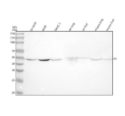 Tissue Factor Antibody Multi-Species WB. Western blot analysis of human, rat, and mouse lysates using Tissue Factor antibody. Lane 1: human SH-SY5Y lysate, Lane 2: human A549 lysate, Lane 3: human PANC-1 lysate, Lane 4: rat lung lysate, Lane 5: rat liver lysate, Lane 6: mouse lung lysate, Lane 7: mouse liver lysate. A predominant band is detected near 45-50 kDa, compared to the predicted molecular weight of Tissue Factor / F3 / CD142 at approximately 35 kDa. The higher apparent molecular weight is consistent with known glycosylation of this membrane-associated coagulation receptor, which can alter electrophoretic mobility during SDS-PAGE analysis. The observed expression pattern supports the role of Tissue Factor in coagulation pathway activation, inflammatory signaling, vascular injury response, and tumor-associated procoagulant activity across multiple mammalian tissues and cell types.