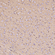 Immunohistochemistry of Glutamine Synthetase Antibody in rat cerebral cortex. Formalin-fixed, paraffin-embedded rat cortex demonstrates diffuse cytoplasmic HRP-DAB brown staining in astrocytic cells distributed throughout the neuropil, consistent with Glutamate-ammonia ligase (GLUL) localization in glial populations. Neuronal cell bodies show comparatively weaker staining, while background is minimal. The antibody was applied at a 1:400 dilution for paraffin-embedded tissue analysis.