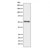 ACPP Antibody western blot analysis of Prostatic acid phosphatase in human prostate cancer lysate. Western blot was performed using human prostate cancer lysate probed with ACPP antibody. A single band is detected at approximately 45-50 kDa, consistent with the predicted molecular weight of Prostatic acid phosphatase (ACP3 / PAP). Detection of this band aligns with the expected expression of PAP in prostate-derived cells and prostate cancer tissue lysates commonly used in prostate biology research.