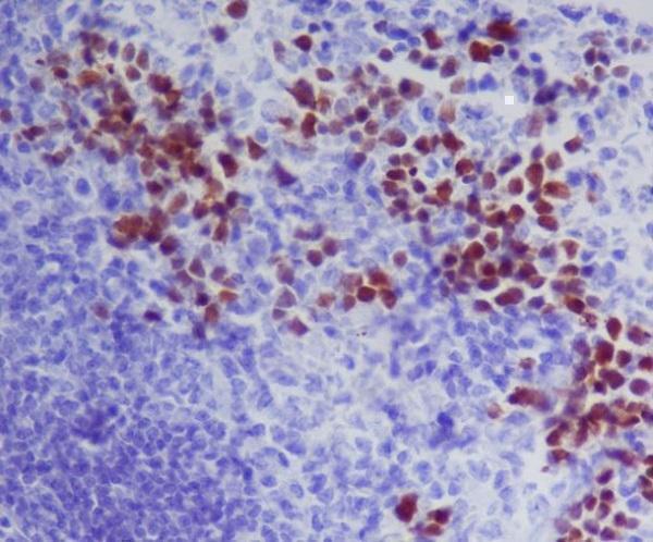GATA1 Antibody Mouse Spleen IHC. Immunohistochemical staining of FFPE mouse spleen with GATA1 antibody demonstrated strong nuclear staining in erythroid precursor cells, consistent with the localization of GATA1 as a lineage-defining transcription factor. GATA1 is a zinc finger transcription factor that regulates genes required for erythropoiesis, hemoglobin synthesis, and terminal maturation of red blood cells while also contributing to megakaryocyte differentiation. The predominantly nuclear staining pattern reflects its role as a transcriptional regulator controlling hematopoietic gene expression. These results support the utility of GATA1 Antibody for studies of hematopoiesis, erythropoiesis, hematologic malignancies, and developmental hematology.