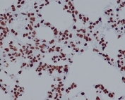 H2AFX Antibody Immunohistochemistry. IHC staining of FFPE rat lung tissue with H2AFX antibody. HIER: boil tissue sections in pH6, 10mM citrate buffer, for 10-20 min and allow to cool before testing.