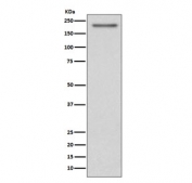 PDGFRA Antibody SH-SY5Y WB. Western blot analysis of human SH-SY5Y cell lysate using PDGFRA Antibody / Platelet-Derived Growth Factor Receptor Alpha Antibody demonstrates a strong immunoreactive band at approximately 180 kDa, consistent with expression of mature PDGFRA protein. PDGFRA is a receptor tyrosine kinase that mediates signaling from platelet-derived growth factors and regulates cellular proliferation, survival, migration, differentiation, and developmental processes. The observed molecular weight is higher than the predicted core protein size due to extensive glycosylation and other post-translational modifications that are characteristic of the mature receptor. The detected band is consistent with endogenous PDGFRA expression in human SH-SY5Y cells. Expected molecular weight: 120-195 kDa.
