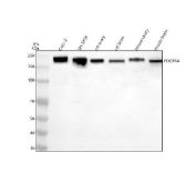 PDGFRA Antibody Human Mouse Rat WB. Western blot analysis of human Caco-2 (lane 1) and SH-SY5Y (lane 2) cell lysates, as well as rat ovary (lane 3), rat brain (lane 4), mouse ovary (lane 5), and mouse brain (lane 6) tissue lysates using PDGFRA Antibody / Platelet-Derived Growth Factor Receptor Alpha Antibody demonstrates strong immunoreactive bands at approximately 180 kDa. PDGFRA is a receptor tyrosine kinase that mediates signaling from platelet-derived growth factors and regulates cellular proliferation, survival, migration, and developmental processes in mesenchymal and stromal cell populations. The observed molecular weight exceeds the predicted size of approximately 123 kDa, a finding consistent with extensive glycosylation and other post-translational modifications known to affect electrophoretic mobility of mature PDGFRA protein. The detected bands support expression of PDGFRA across human, rat, and mouse samples. Predicted molecular weight: approximately 123 kDa. Observed molecular weight: approximately 180 kDa.