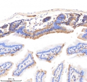 EpCAM Antibody Mouse Small Intestine IHC. Immunohistochemistry staining of FFPE mouse small intestine tissue using EpCAM Antibody demonstrates strong membranous HRP-DAB brown staining throughout the intestinal epithelial lining, including enterocytes lining the villi and crypt-associated epithelial structures. The staining pattern is consistent with expression of Epithelial Cell Adhesion Molecule (EPCAM/CD326), a transmembrane glycoprotein involved in epithelial cell adhesion, maintenance of tissue architecture, and regulation of epithelial differentiation. Prominent membrane localization highlights the organized epithelial compartment of the intestinal mucosa and is consistent with the established expression of EPCAM in gastrointestinal epithelial tissues. The observed staining supports the use of EpCAM as a marker for epithelial cell identification, tissue organization studies, and investigations of intestinal epithelial biology. HIER: boil tissue sections in pH 8 EDTA buffer for 20 minutes and allow to cool before testing.