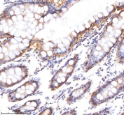 EpCAM Antibody Human Colon IHC. Immunohistochemistry staining of FFPE human colon tissue using EpCAM Antibody demonstrates distinct membranous HRP-DAB brown staining throughout the colonic epithelial lining, including surface epithelial cells and glandular crypt structures. The staining pattern is consistent with expression of Epithelial Cell Adhesion Molecule (EPCAM/CD326), a transmembrane glycoprotein involved in epithelial cell adhesion, maintenance of tissue architecture, and regulation of epithelial differentiation. Strong membrane-associated staining highlights the organized epithelial compartment of the colonic mucosa, while underlying stromal and connective tissue elements remain largely negative. The observed immunoreactivity is consistent with the established expression of EpCAM in normal gastrointestinal epithelium and supports its use as a marker for epithelial cell identification, tissue organization studies, and epithelial lineage characterization. HIER: boil tissue sections in pH 8 EDTA buffer for 20 minutes and allow to cool before testing.