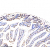 EpCAM Antibody Mouse Small Intestine Villus IHC. Immunohistochemistry staining of FFPE mouse small intestine tissue using EpCAM Antibody demonstrates distinct membranous HRP-DAB brown staining along the epithelial lining of intestinal villi and crypt structures. The staining pattern is consistent with expression of Epithelial Cell Adhesion Molecule (EPCAM/CD326), a cell surface glycoprotein that mediates epithelial cell adhesion and contributes to maintenance of epithelial integrity and tissue architecture. Strong localization at epithelial cell borders highlights the highly organized nature of the intestinal mucosa and is consistent with the established expression of EPCAM throughout gastrointestinal epithelial compartments. The observed staining supports the use of EpCAM as a marker for epithelial cell identification, intestinal epithelial differentiation, and studies of epithelial tissue organization. HIER: boil tissue sections in pH 8 EDTA buffer for 20 minutes and allow to cool before testing.