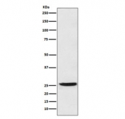 Western blot testing of human SW480 cell lysate with 15-PGDH antibody. A strong band was detected at approximately 26 kDa, which is slightly lower than the predicted 29 kDa but consistent with the known migration behavior of HPGD reported in the literature.