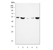 MMP1 Antibody Human Tissue and Cancer Cell WB. Western blot analysis using MMP1 Antibody / Interstitial Collagenase Antibody. Lane 1: human placenta; Lane 2: human Caco-2 cells; Lane 3: human K562 cells; Lane 4: human U-2 OS cells; Lane 5: human MCF7 cells. A specific band is detected at approximately 54 kDa, consistent with the predicted molecular weight of the MMP1 proenzyme (pro-MMP1). These results support the use of MMP1 Antibody / Interstitial Collagenase Antibody for studying extracellular matrix remodeling, interstitial collagenase expression and cancer-associated tissue remodeling pathways.