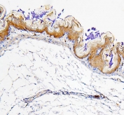 ALDH1A1 Antibody Mouse Stomach IHC. Immunohistochemistry analysis of FFPE mouse stomach tissue stained with ALDH1A1 Antibody / Cancer Stem Cell and Retinoic Acid Metabolism Marker. Strong cytoplasmic HRP-DAB brown staining is observed within the gastric epithelial lining, consistent with expression of Aldehyde dehydrogenase 1 family member A1 / ALDH1A1 in metabolically active epithelial cells involved in aldehyde detoxification and retinoic acid metabolism. Hematoxylin counterstain highlights nuclei in blue. HIER: boil tissue sections in 10 mM citrate buffer, pH6, for 20 min followed by cooling before testing.