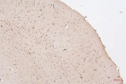 IHC staining of FFPE mouse brain with HMGB1 antibody. HIER: boil tissue sections in pH6, 10mM citrate buffer, for 20 min and allow to cool before testing.